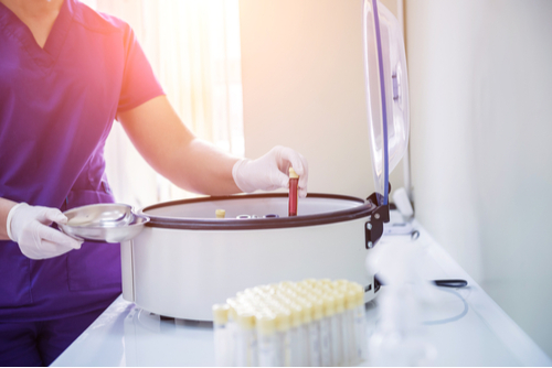 A Photo For A Blog Post About Is Platelet Rich Plasma The Same As Stem Cells?