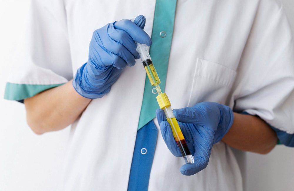 Microneedling With Exosomes Vs PRP