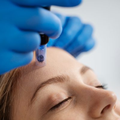 Microneedlingseattle