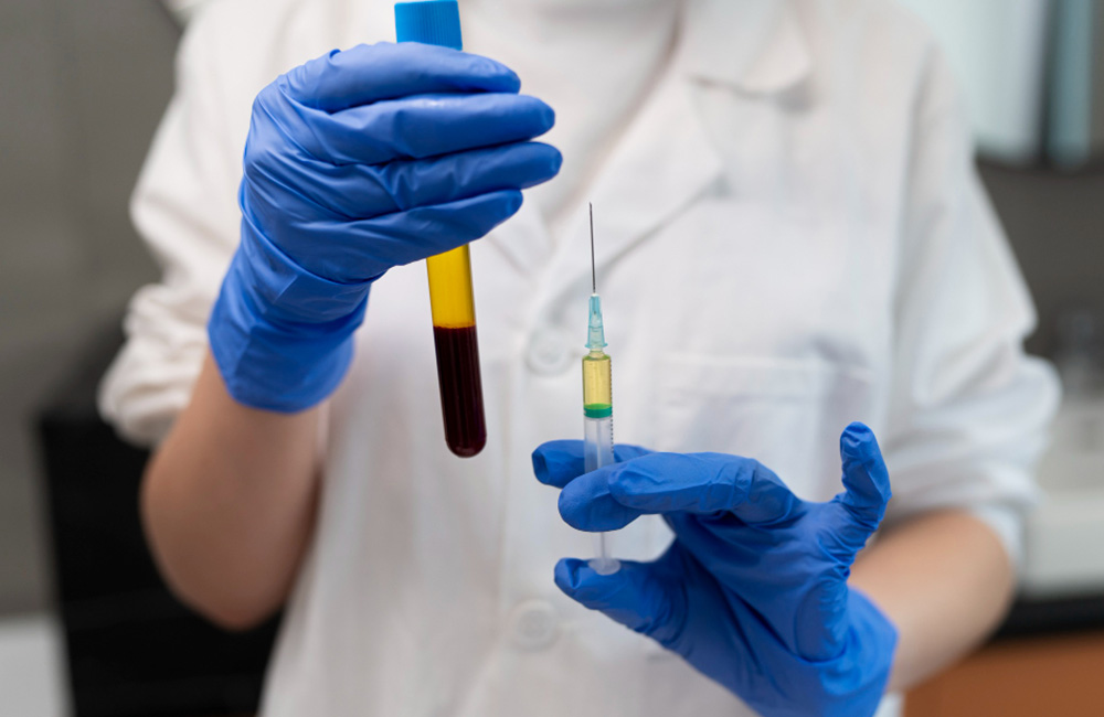 Side Effects of PRP Injections