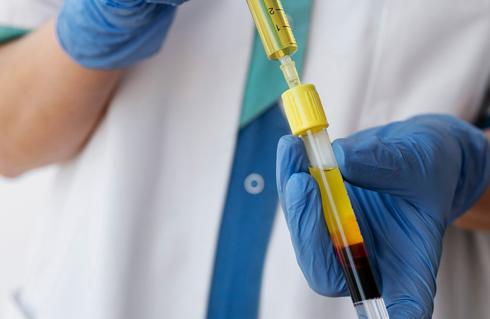 Best Blood Collection Tubes for PRP