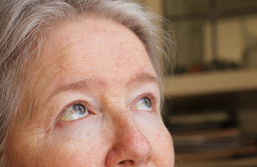 Swelling Last After PRP Under Eyes