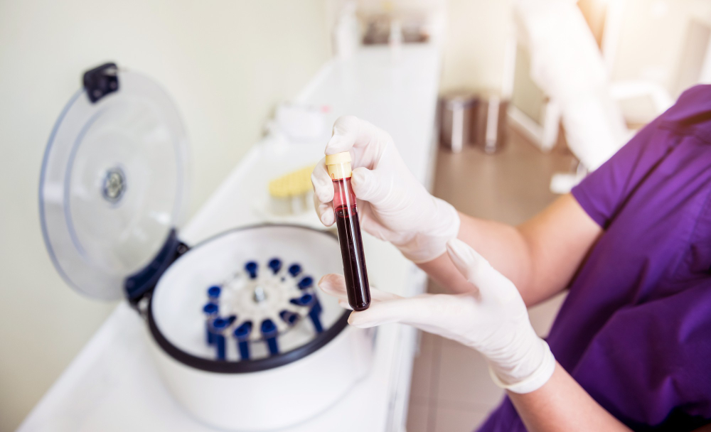 How Much Does PRP Treatment Cost in Seattle?