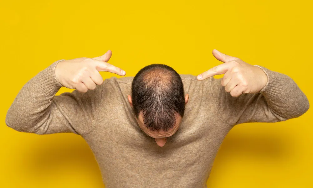 Who Is a Good Candidate for PRP Crown Treatment?
