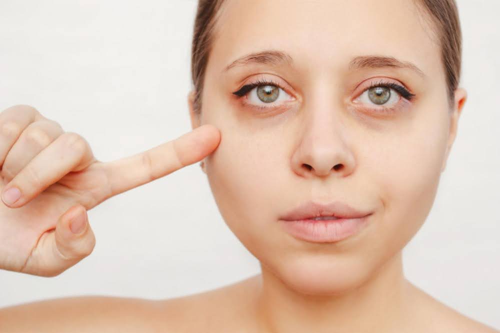 What Causes Under-Eye Hollows as You Age?