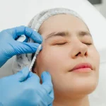 Can PRP Help Restore Thinning Eyebrows?