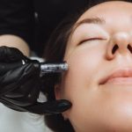 How Many Microneedling with PRP Sessions Do You Really Need?